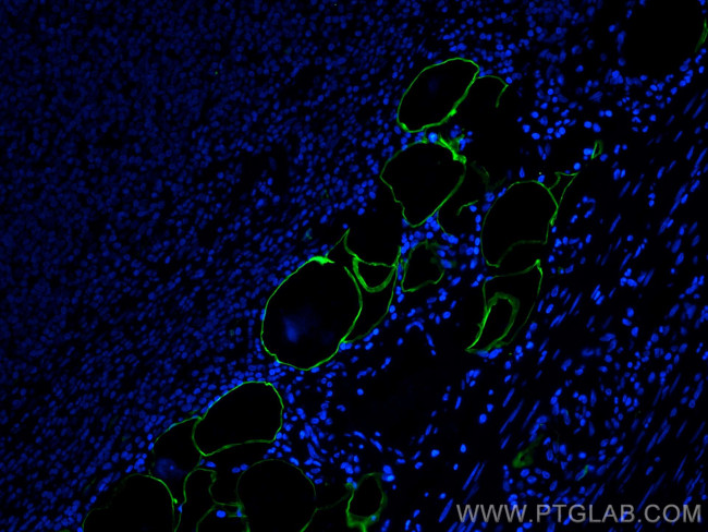 E-selectin/CD62E Antibody in Immunohistochemistry (PFA fixed) (IHC (PFA))