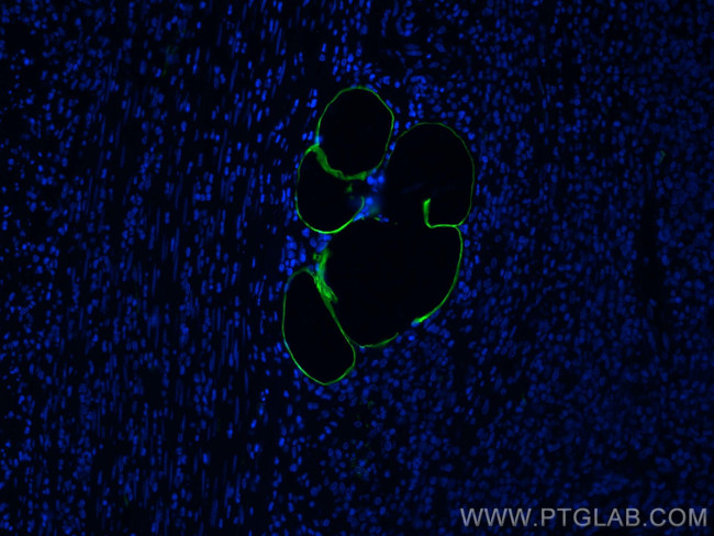 E-selectin/CD62E Antibody in Immunohistochemistry (PFA fixed) (IHC (PFA))