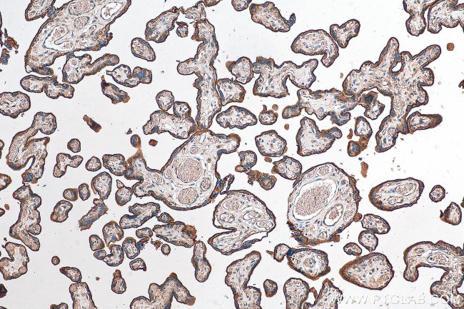 CD59 Antibody in Immunohistochemistry (Paraffin) (IHC (P))