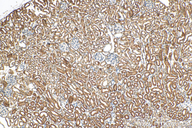 C1orf54 Antibody in Immunohistochemistry (Paraffin) (IHC (P))