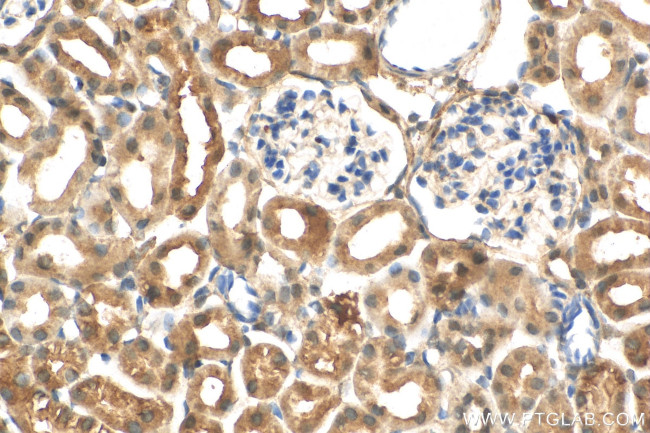 C1orf54 Antibody in Immunohistochemistry (Paraffin) (IHC (P))