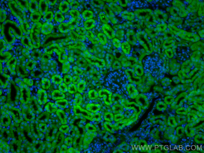 C1orf54 Antibody in Immunohistochemistry (PFA fixed) (IHC (PFA))