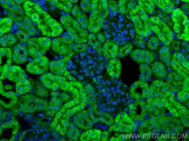 C1orf54 Antibody in Immunohistochemistry (PFA fixed) (IHC (PFA))