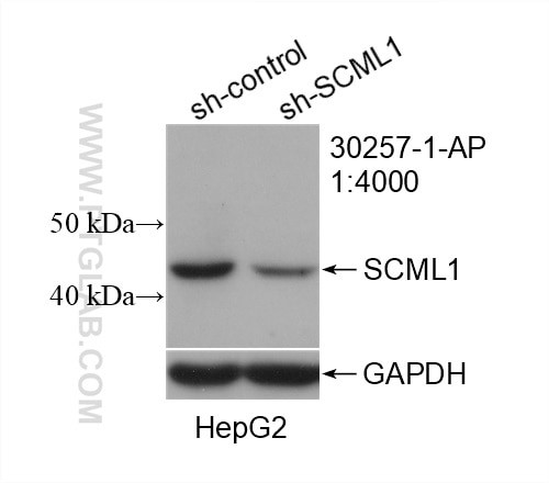 SCML1 Antibody in Western Blot (WB)