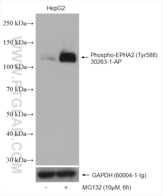 Phospho-EPHA2 (Tyr588) Antibody in Western Blot (WB)