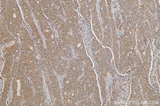 PSMB7 Antibody in Immunohistochemistry (Paraffin) (IHC (P))