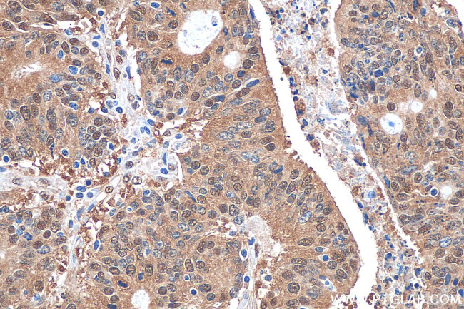 PSMB7 Antibody in Immunohistochemistry (Paraffin) (IHC (P))