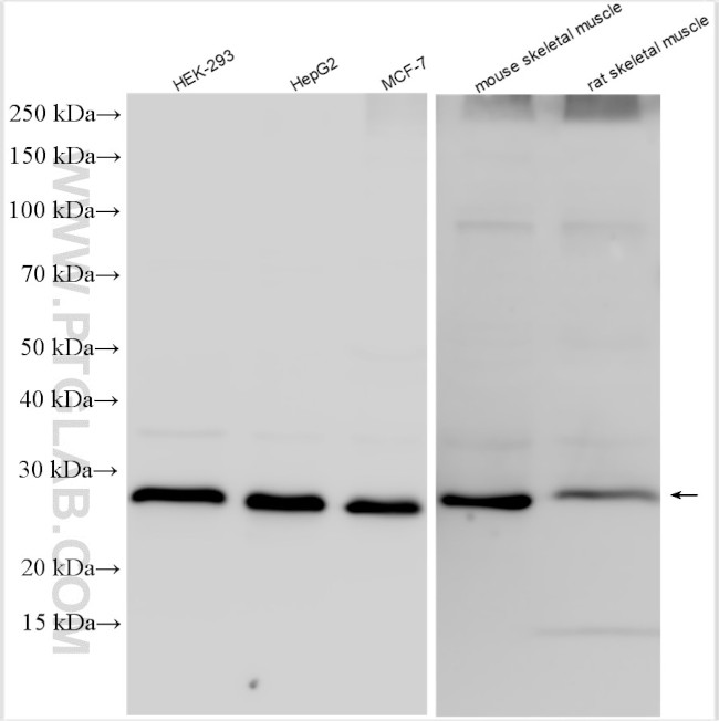 PSMB7 Antibody in Western Blot (WB)