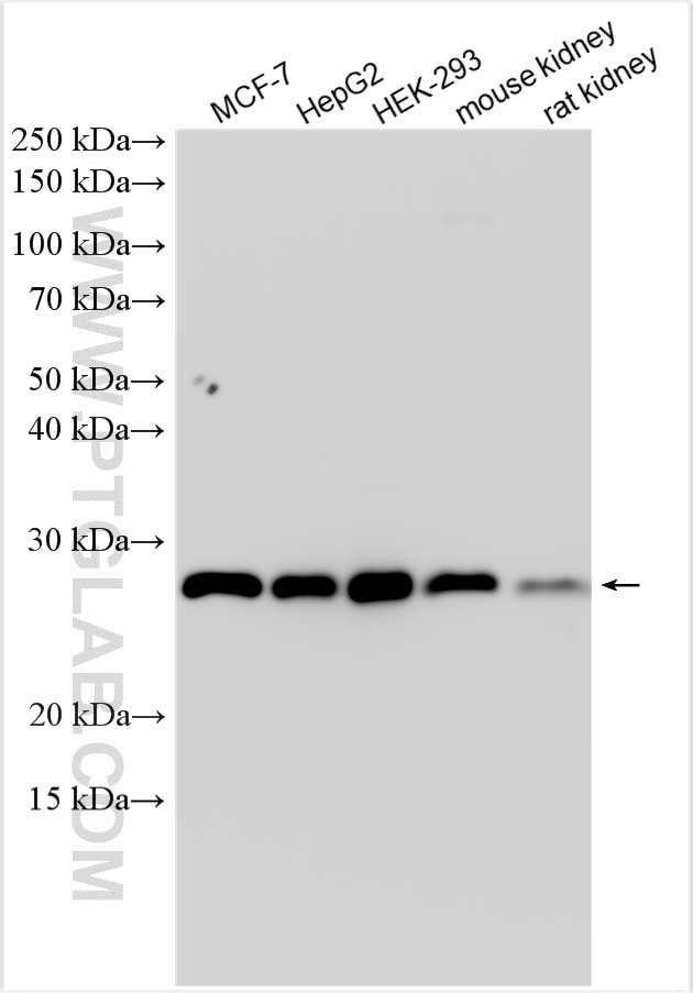 PSMB7 Antibody in Western Blot (WB)