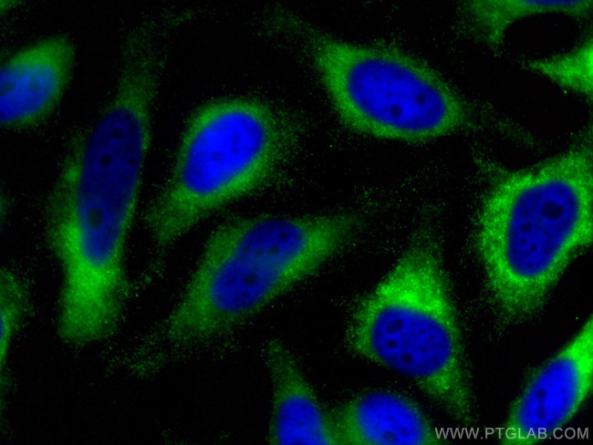 CCBL1 Antibody in Immunocytochemistry (ICC/IF)