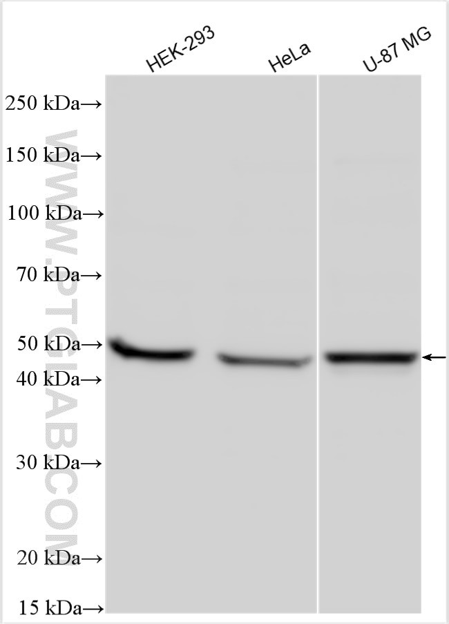 CCBL1 Antibody in Western Blot (WB)