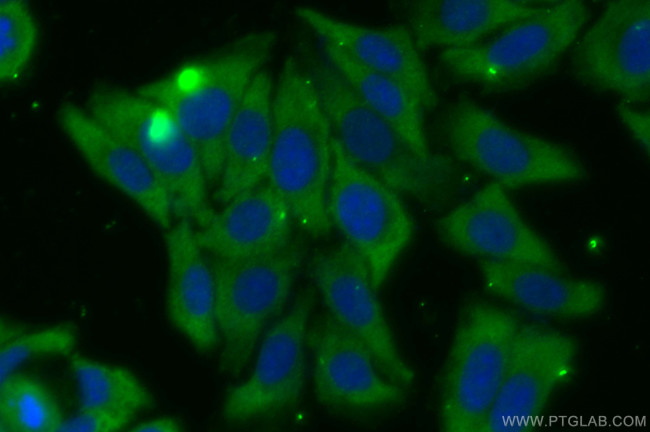 PFKM Antibody in Immunocytochemistry (ICC/IF)