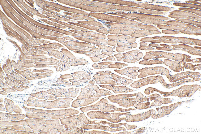 PFKM Antibody in Immunohistochemistry (Paraffin) (IHC (P))