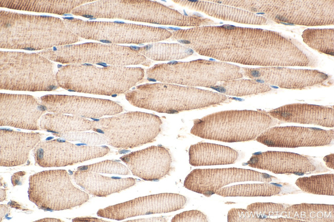 PFKM Antibody in Immunohistochemistry (Paraffin) (IHC (P))