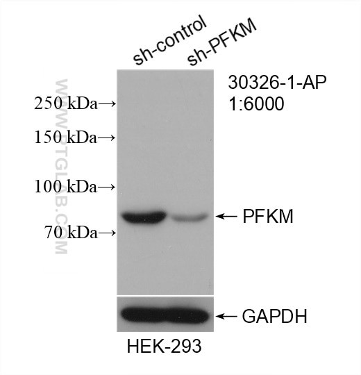 PFKM Antibody in Western Blot (WB)