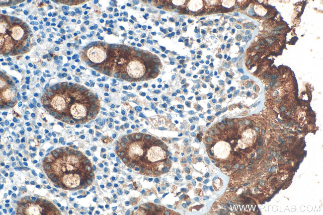 CEACAM1 Antibody in Immunohistochemistry (Paraffin) (IHC (P))