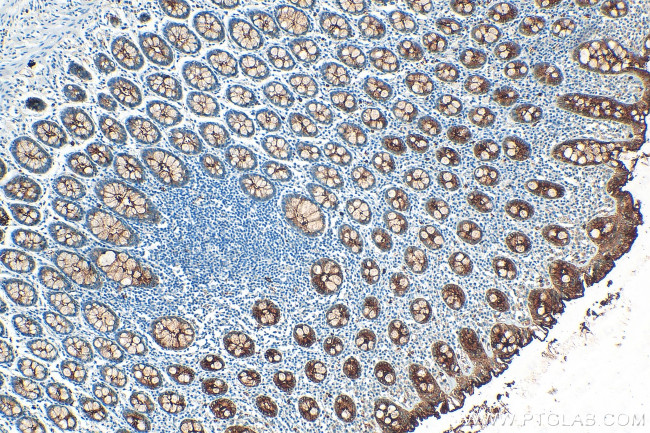 CEACAM1 Antibody in Immunohistochemistry (Paraffin) (IHC (P))