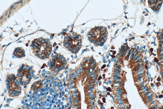 SYNJ2 Antibody in Immunohistochemistry (Paraffin) (IHC (P))