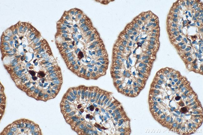 SYNJ2 Antibody in Immunohistochemistry (Paraffin) (IHC (P))