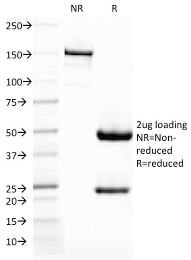 CD209/DC-SIGN (Pathogen Receptor on Dendritic Cells) Antibody in SDS-PAGE (SDS-PAGE)