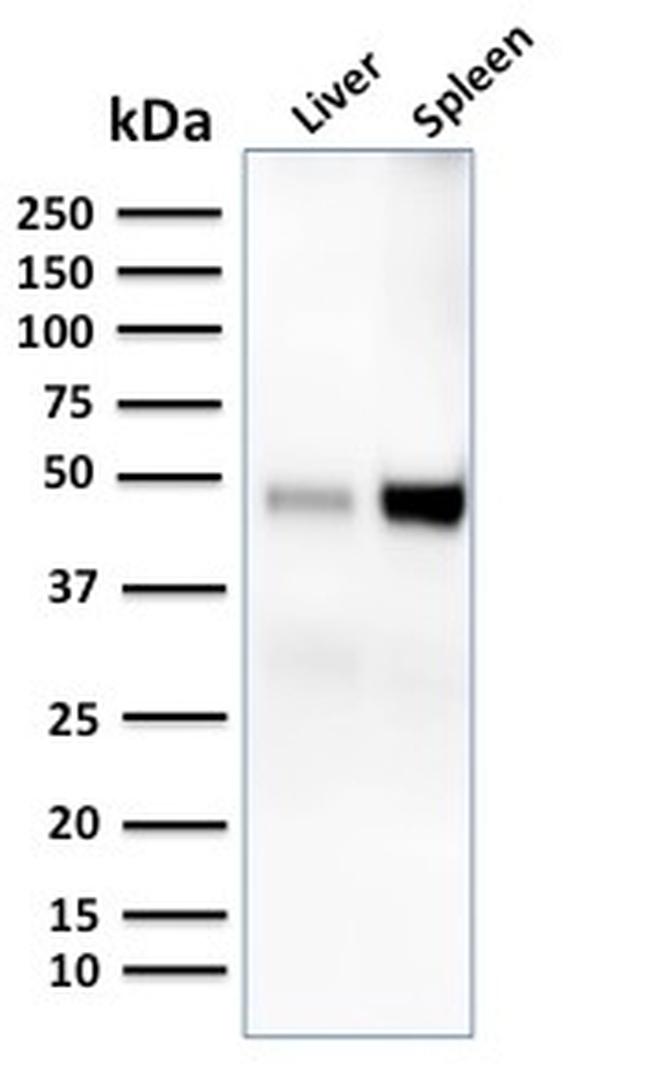 CD209/DC-SIGN (Pathogen Receptor on Dendritic Cells) Antibody in Western Blot (WB)