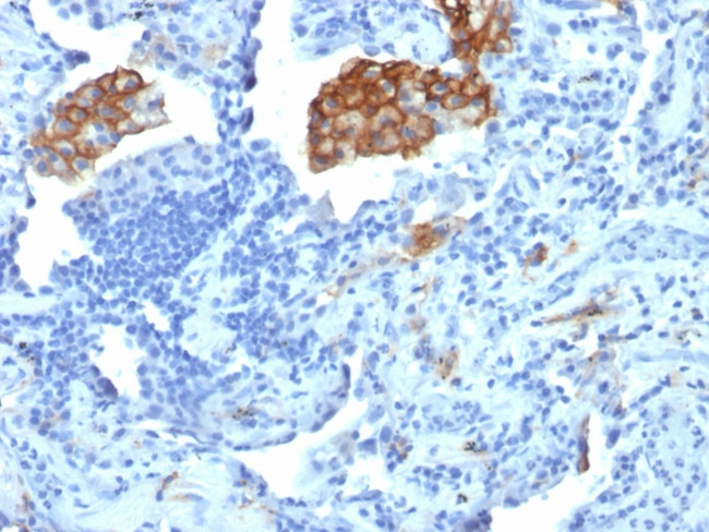 CD209/DC-SIGN (Pathogen Receptor on Dendritic Cells) Antibody in Immunohistochemistry (Paraffin) (IHC (P))