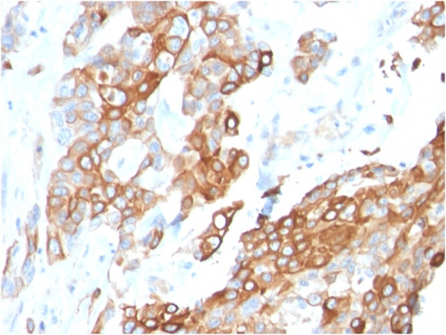 Heregulin-1/Neuregulin-1 (Breast and Urothelial Marker) Antibody in Immunohistochemistry (Paraffin) (IHC (P))