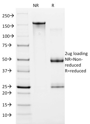 HIF1 alpha (Hypoxia-Inducible Factor 1-alpha) Antibody in SDS-PAGE (SDS-PAGE)