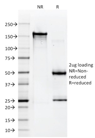 HLA-A (MHC I) Antibody in SDS-PAGE (SDS-PAGE)