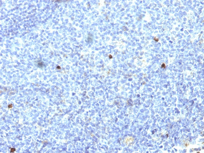 HLA-Aw32 and HLA-A25 (MHC I) Antibody in Immunohistochemistry (Paraffin) (IHC (P))