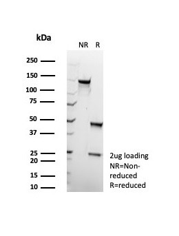 HLA-B (MHC Class I) Antibody in SDS-PAGE (SDS-PAGE)