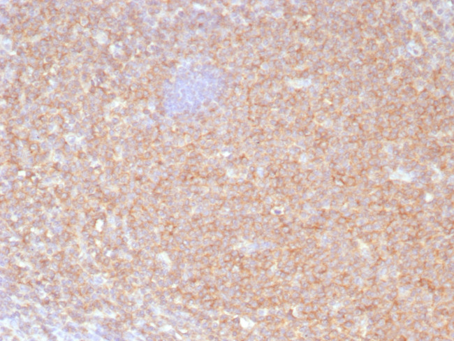 HLA-B (MHC Class I) Antibody in Immunohistochemistry (Paraffin) (IHC (P))