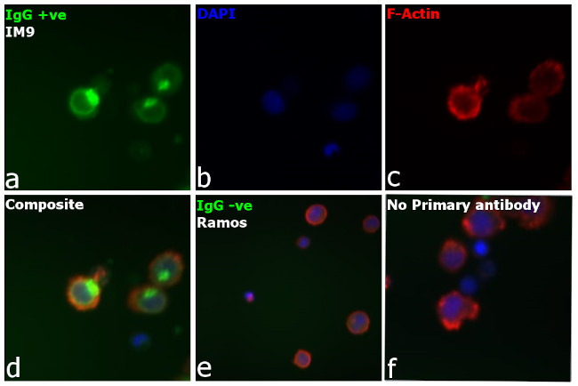 Human IgG Fc Cross-Adsorbed Secondary Antibody in Immunocytochemistry (ICC/IF)