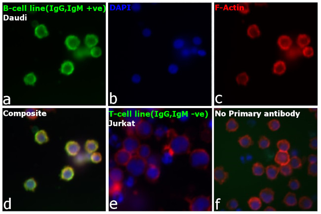 Human IgG, IgM, IgA (H+L) Secondary Antibody in Immunocytochemistry (ICC/IF)