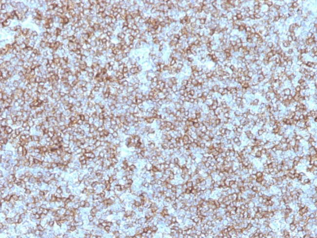 HLA-DP/-DR (MHC II) Antibody in Immunohistochemistry (Paraffin) (IHC (P))