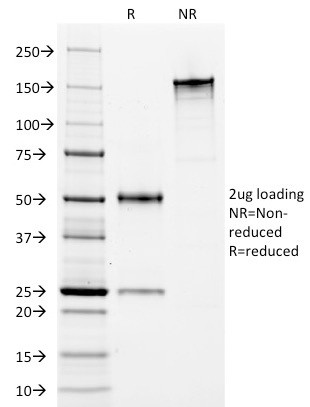 HLA-DP/-DR (MHC II) Antibody in SDS-PAGE (SDS-PAGE)