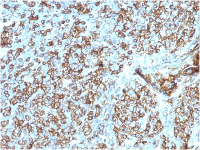 HLA-DP/-DQ/-DR (MHC II) Antibody in Immunohistochemistry (Paraffin) (IHC (P))