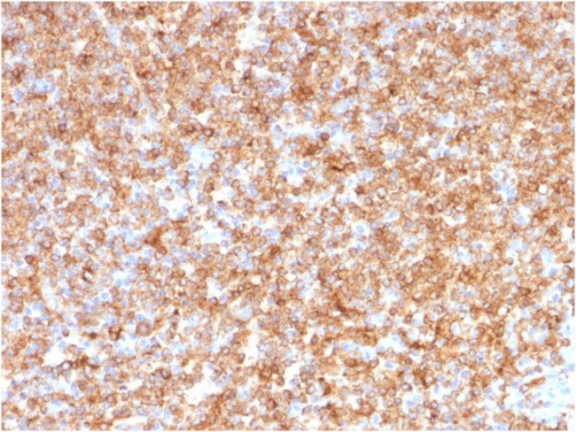 HLA-DP/-DQ/-DR (MHC II) Antibody in Immunohistochemistry (Paraffin) (IHC (P))