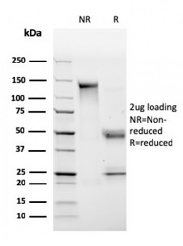 HLA-DP/-DQ/-DR (MHC II) Antibody in SDS-PAGE (SDS-PAGE)