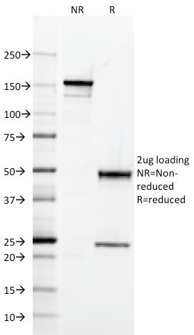 HLA-DQ (MHC II) Antibody in SDS-PAGE (SDS-PAGE)