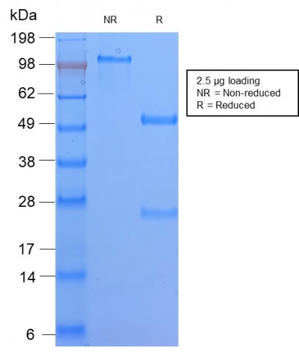 HLA-DQ (MHC II) Antibody in SDS-PAGE (SDS-PAGE)