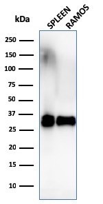 HLA-DR (MHC II) Antibody in Western Blot (WB)