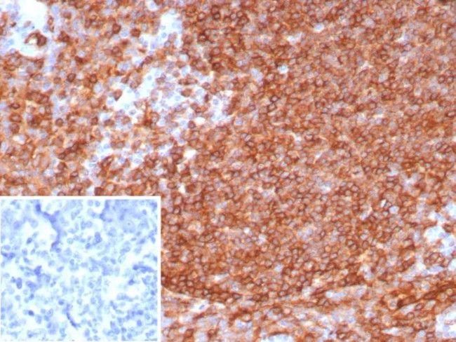 HLA-DR (MHC II) Antibody in Immunohistochemistry (Paraffin) (IHC (P))