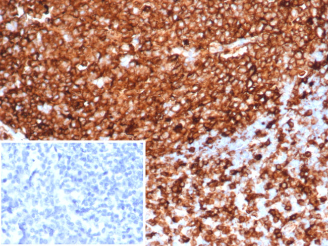 HLA-DR (MHC II) Antibody in Immunohistochemistry (Paraffin) (IHC (P))