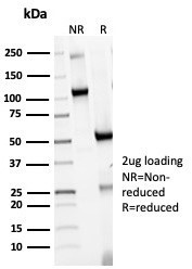 HLA-DR (MHC II) Antibody in SDS-PAGE (SDS-PAGE)