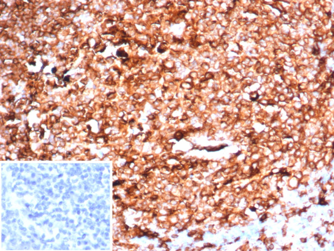 HLA-DR (MHC II) Antibody in Immunohistochemistry (Paraffin) (IHC (P))