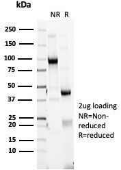 HLA-DR (MHC II) Antibody in SDS-PAGE (SDS-PAGE)