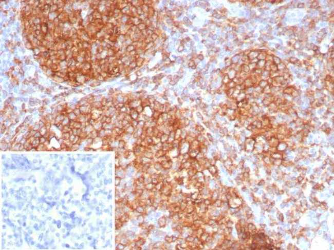 HLA-DR (MHC II) Antibody in Immunohistochemistry (Paraffin) (IHC (P))