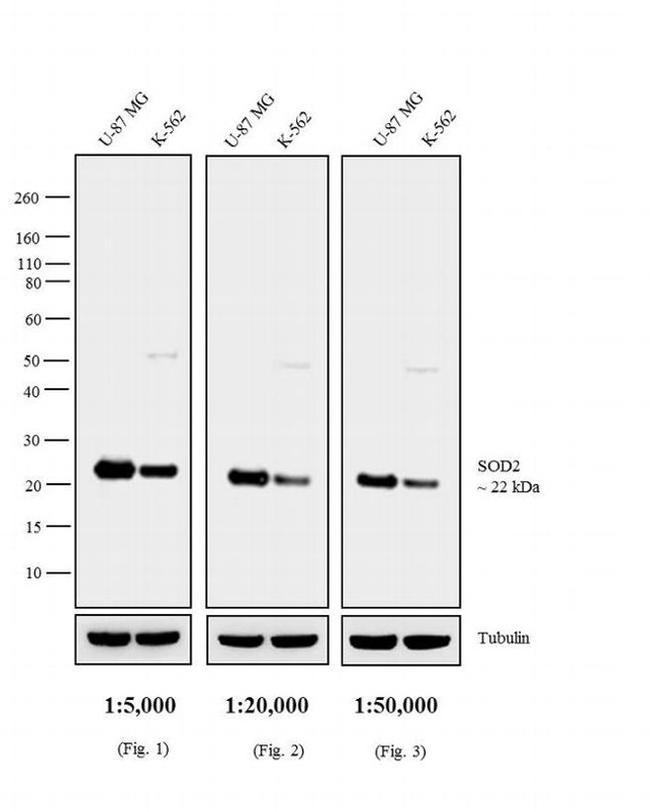 Mouse IgG, IgM (H+L) Cross-Adsorbed Secondary Antibody in Western Blot (WB)