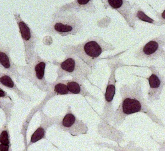 Rabbit IgG (H+L) Secondary Antibody in Immunocytochemistry (ICC/IF)